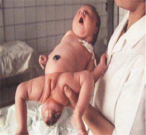 輻射后果 輻射后果